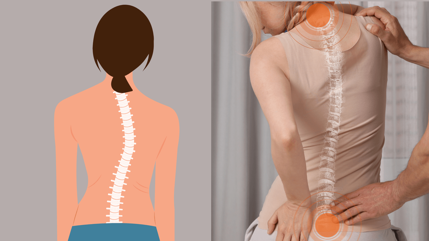scoliosis pain spine