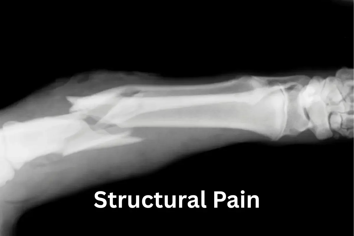 Comparison: X-ray of broken bone for structural pain next to person thoughtfully sensing neuroplastic pain.