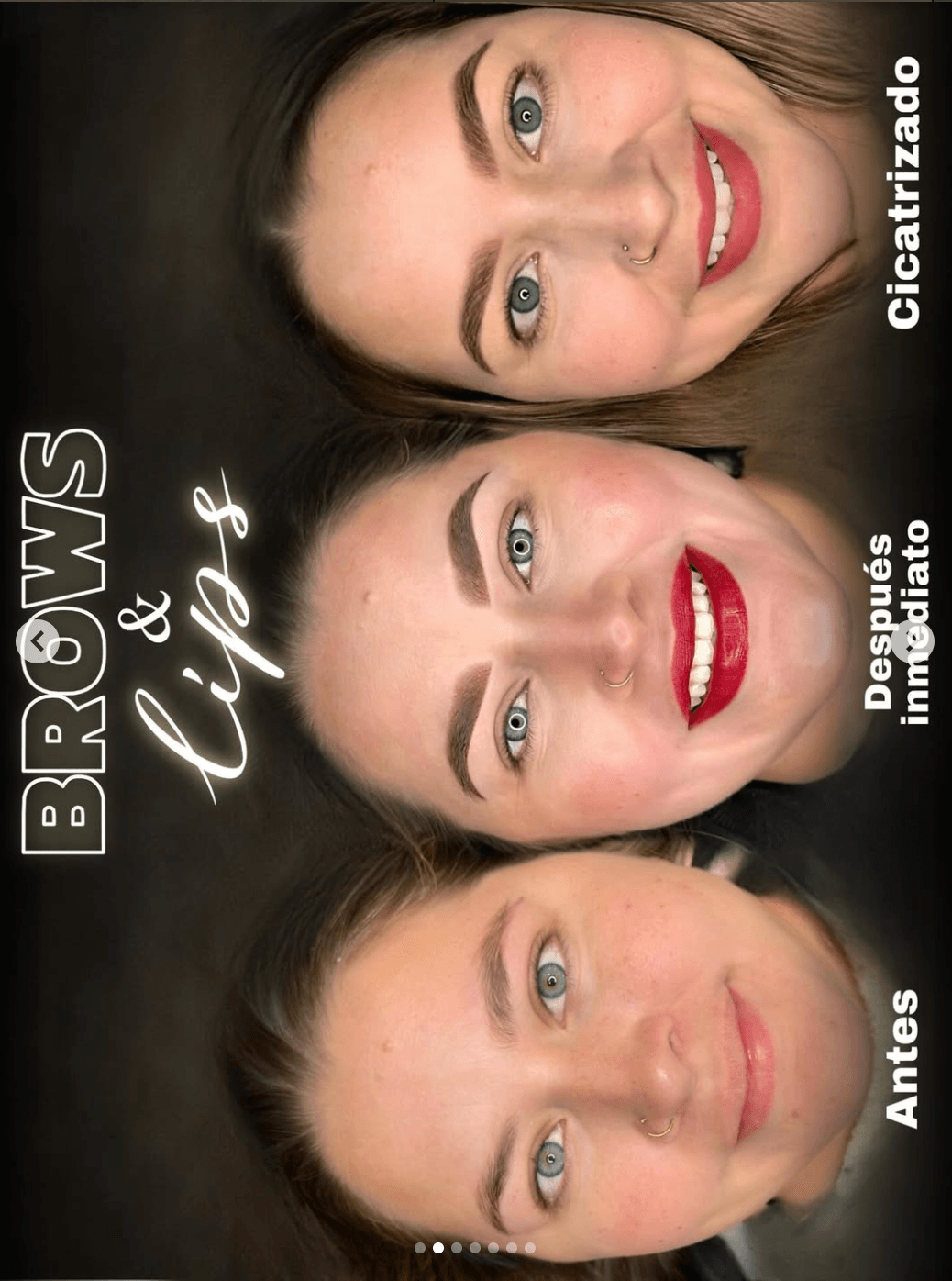 Resultado de micropigmentación de cejas: antes, después y cicatrizado