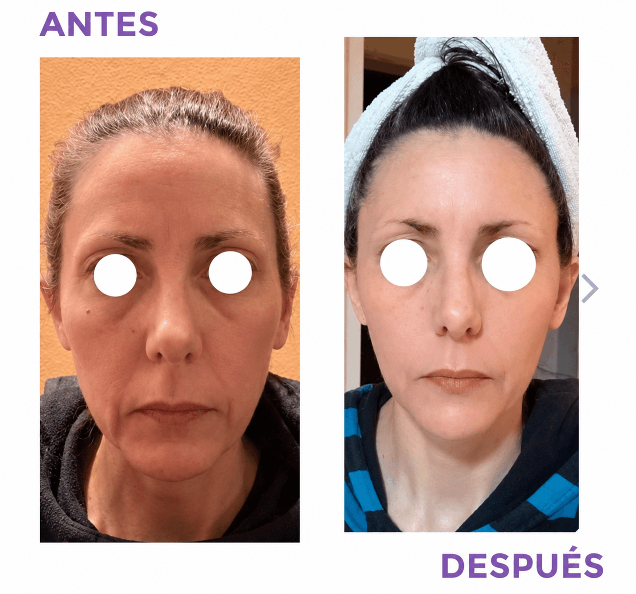 Transformación facial de Laura