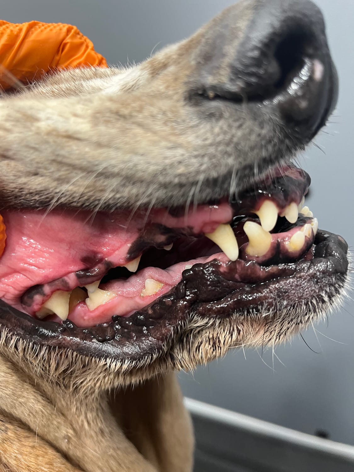Teeth cleaning service