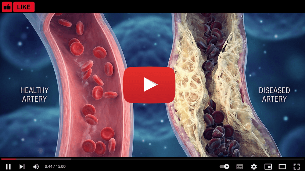 Watch the free video