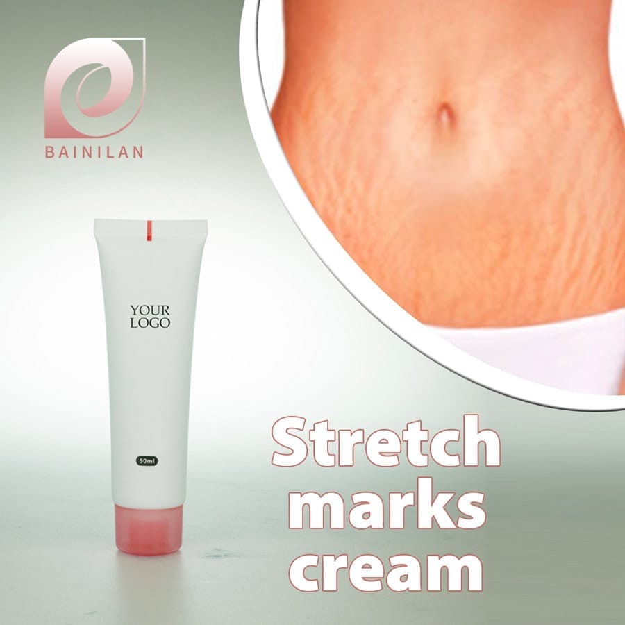 OEM stretch marks cream – Private Label Skincare Manufactured in China