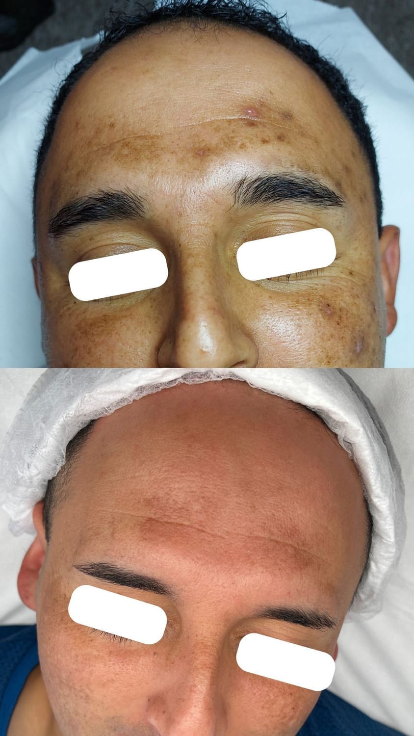 Antes y después