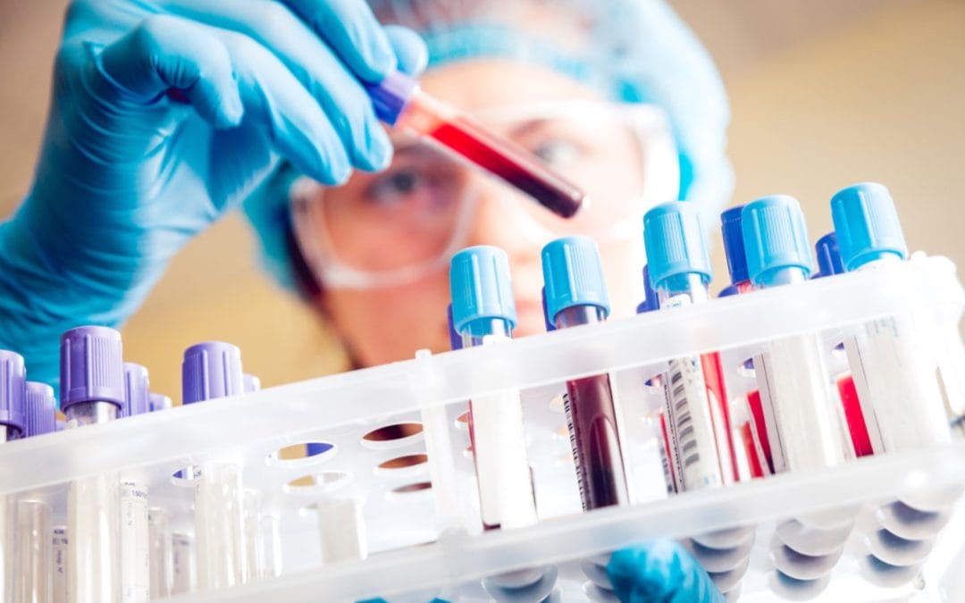 TRT blood testing at MHI Algarve clinic