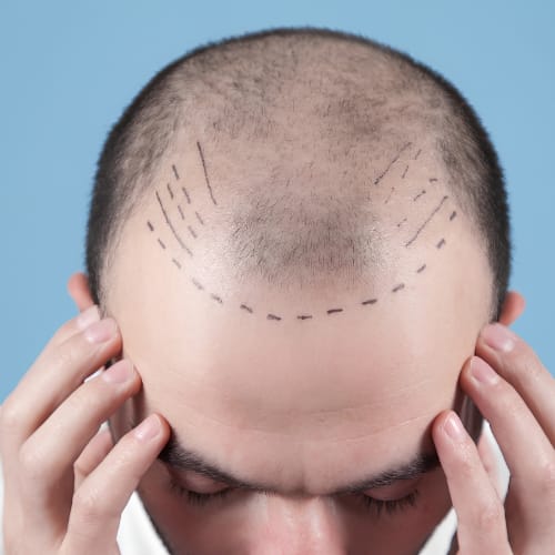 Hair and Scalp care