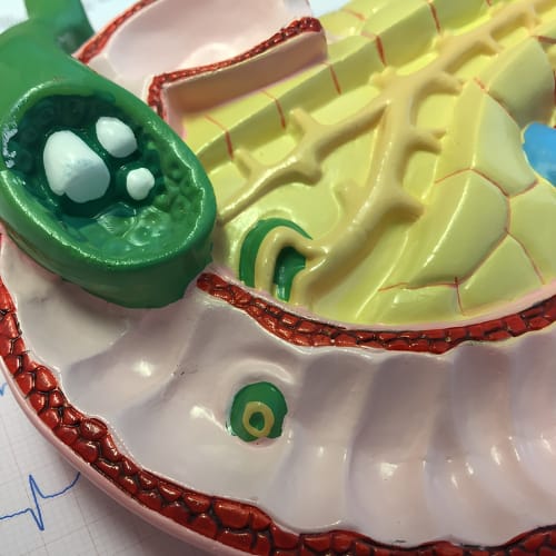 Gallbladder and Stones care